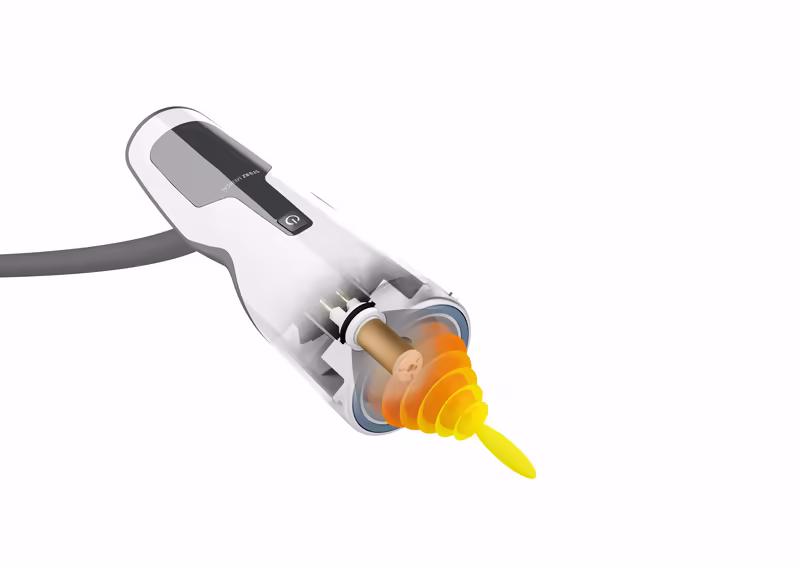 DuoLith SD1 shockwave applicator
