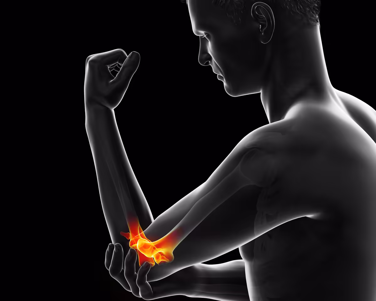 Illustration of an arm with the elbow highlighted in orange